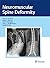 Neuromuscular Spine Deformity by Amer F. Samdani