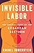 Invisible Labor: The Untold Story of the Cesarean Section