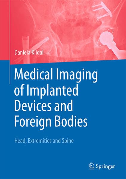 Medical Imaging of Implanted Devices and Foreign Bodies: Head, Extremities and Spine (Hardcover)
