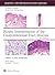 Biopsy Interpretation of th...
