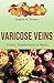 VARICOSE VEINS. Foods, Supp...