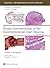 Biopsy Interpretation of th...