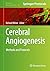 Cerebral Angiogenesis: Methods and Protocols (Methods in Molecular Biology Book 1135)
