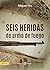 Seis heridas de arma de fuego