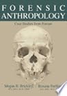 Forensic Anthropology by Megan B. Brickley