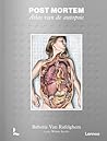 Post Mortem