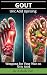 GOUT by Ashish Puri