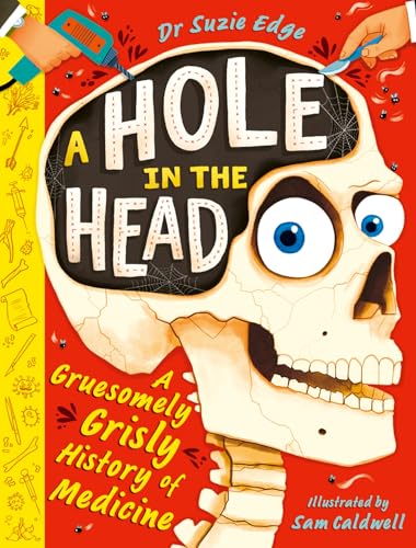 A Hole in the Head: A gruesomely grisly history of medical firsts (Kindle Edition)