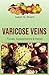VARICOSE VEINS. Foods, Supp...