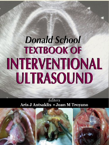 Donald School Textbook of Interventional Ultrasound (Hardcover)
