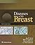 Diseases of the Breast