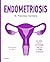 Endometriosis: La guía para entender qué es y cómo cuidarte (Spanish Edition)