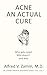Acne : An Actual Cure
