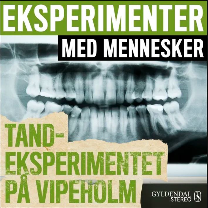 Tandeksperimentet på Vipeholm