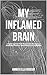 My Inflamed Brain by Amber Bodeur