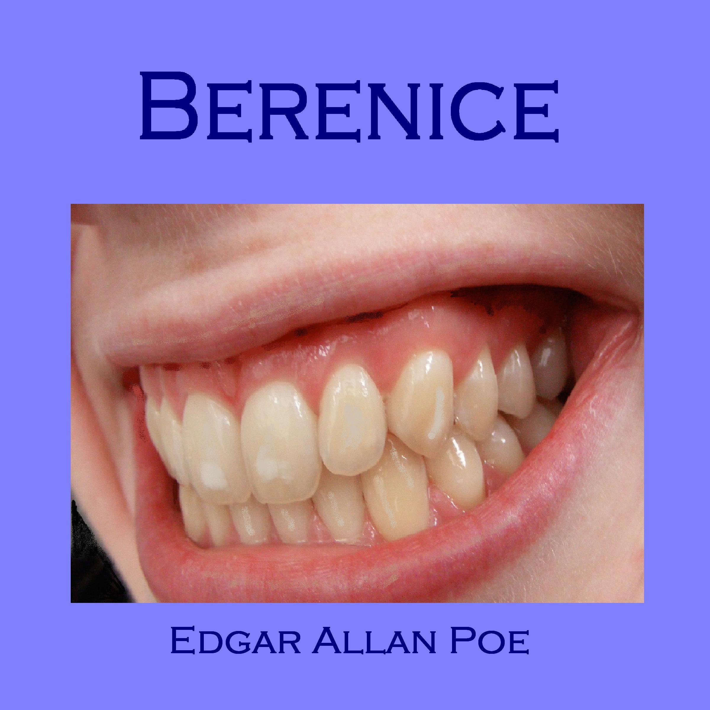 Berenice