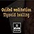 Guided Meditation for Thyroid Healing by Stuart Newman
