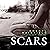 Scars
