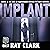 Implant: DI Stewart Gardner, Book 3