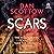 Scars