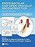Endovascular and Open Vascu...
