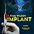 Implant Lib/E