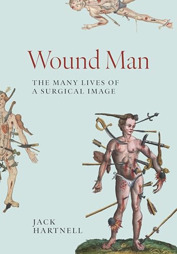 Wound Man: The Many Lives of a Surgical Image (Hardcover)