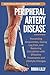 Peripheral Artery Disease by Robin Lilly