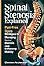 Spinal Stenosis Explained: Pain-Free Spine: Strategies for Managing Spinal Stenosis and Enhancing Mobility