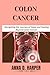 COLON CANCER: Navigating th...