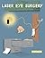 Laser Eye Surgery