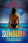 Sunburn