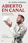 Abierto en canal:...