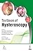 Textbook of Hysteroscopy