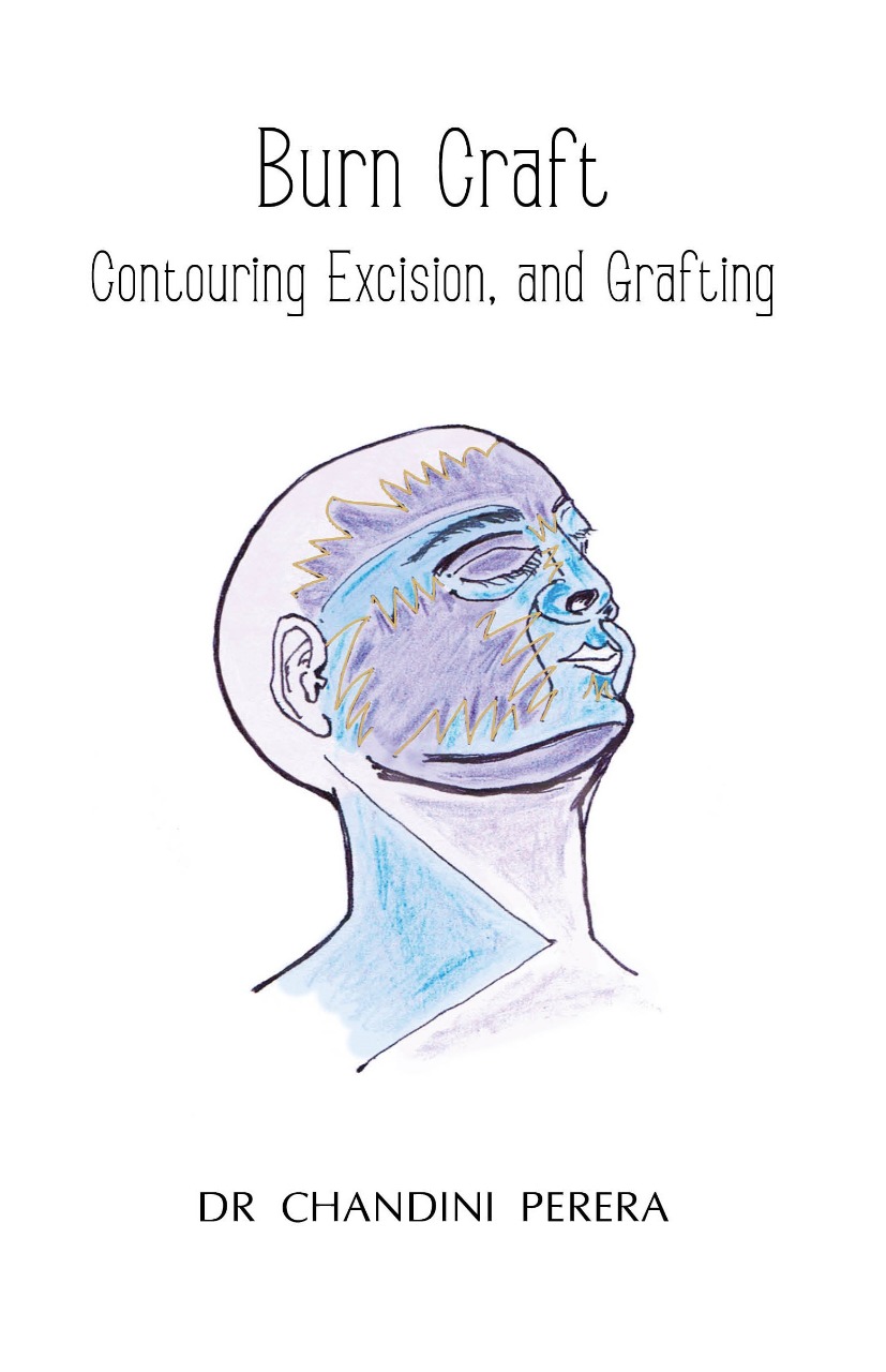 Burn Craft: Contouring Excision, and Grafting