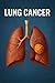Lung Cancer: A Comprehensiv...