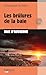 Les brûlures de la baie: Le...
