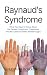 Raynaud’s Syndrome: What You Need to Know About the Causes, Symptoms, Treatments, and the Latest Scientific Breakthroughs