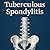 Tuberculous Spondylitis: al...