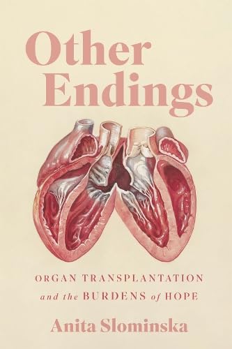 Other Endings: Organ Transplantation and the Burdens of Hope (Paperback)