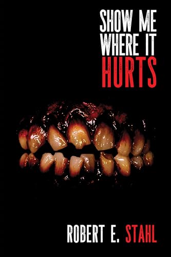 Show Me Where It Hurts (Kindle Edition)