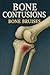 Bone Contusions (Bone Bruis...