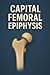 Capital Femoral Epiphysis: ...