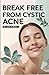 Break Free from Cystic Acne...