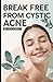 Break Free from Cystic Acne by Lucy K. Bolt