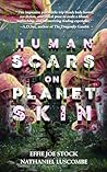 Human Scars on Pl...