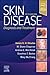 Skin Disease: Diagnosis and Treatment