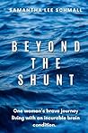 Beyond the Shunt