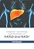 Diagnosis, Monitoring and T...