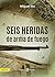 Seis heridas de arma de fuego